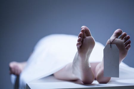 Body lying on a mortuary slab.