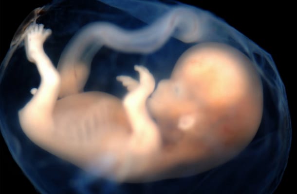 An intellectual embryo awakens